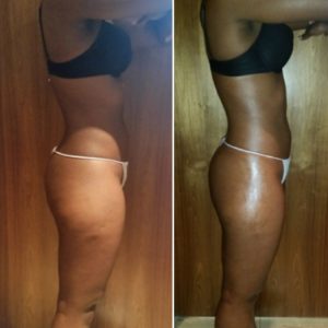 bioslimming body wrap before and after